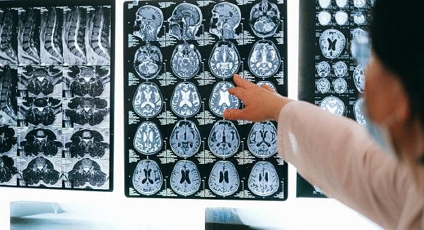 The Neurological Impact of COVID-19 & 5 Simple Steps to Take