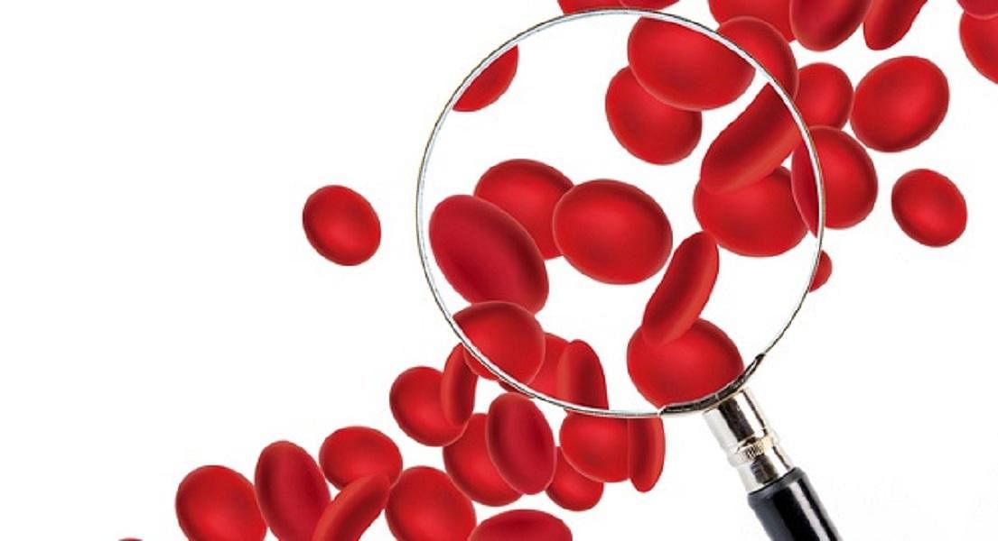 Anaemia: More Than Just Iron Deficiency